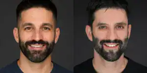 AI vs Professional Photographer
